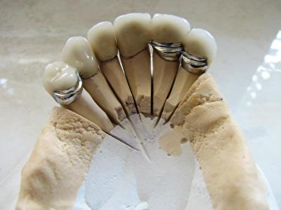 Skelet 1